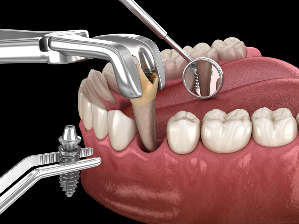 DentOne