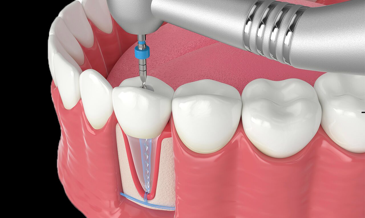 DentOne