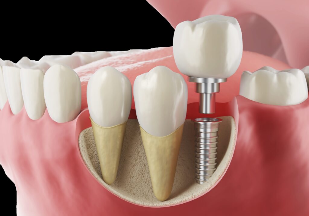 DentOne