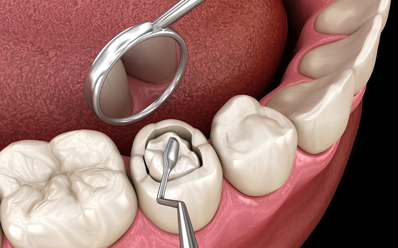 DentOne