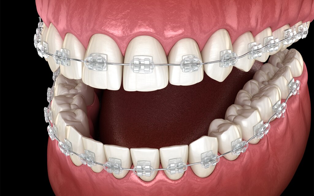 DentOne
