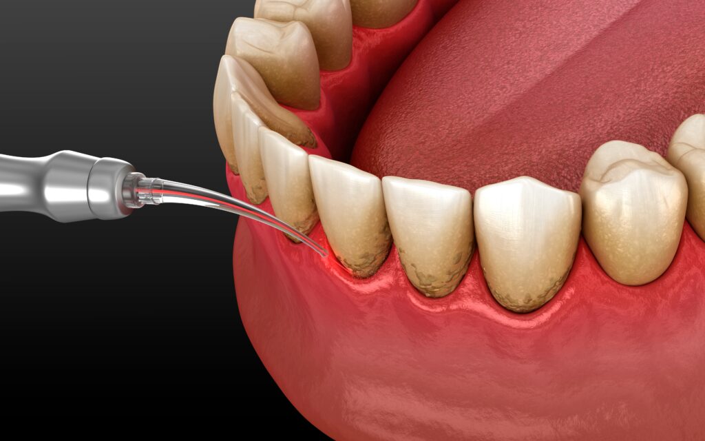 DentOne