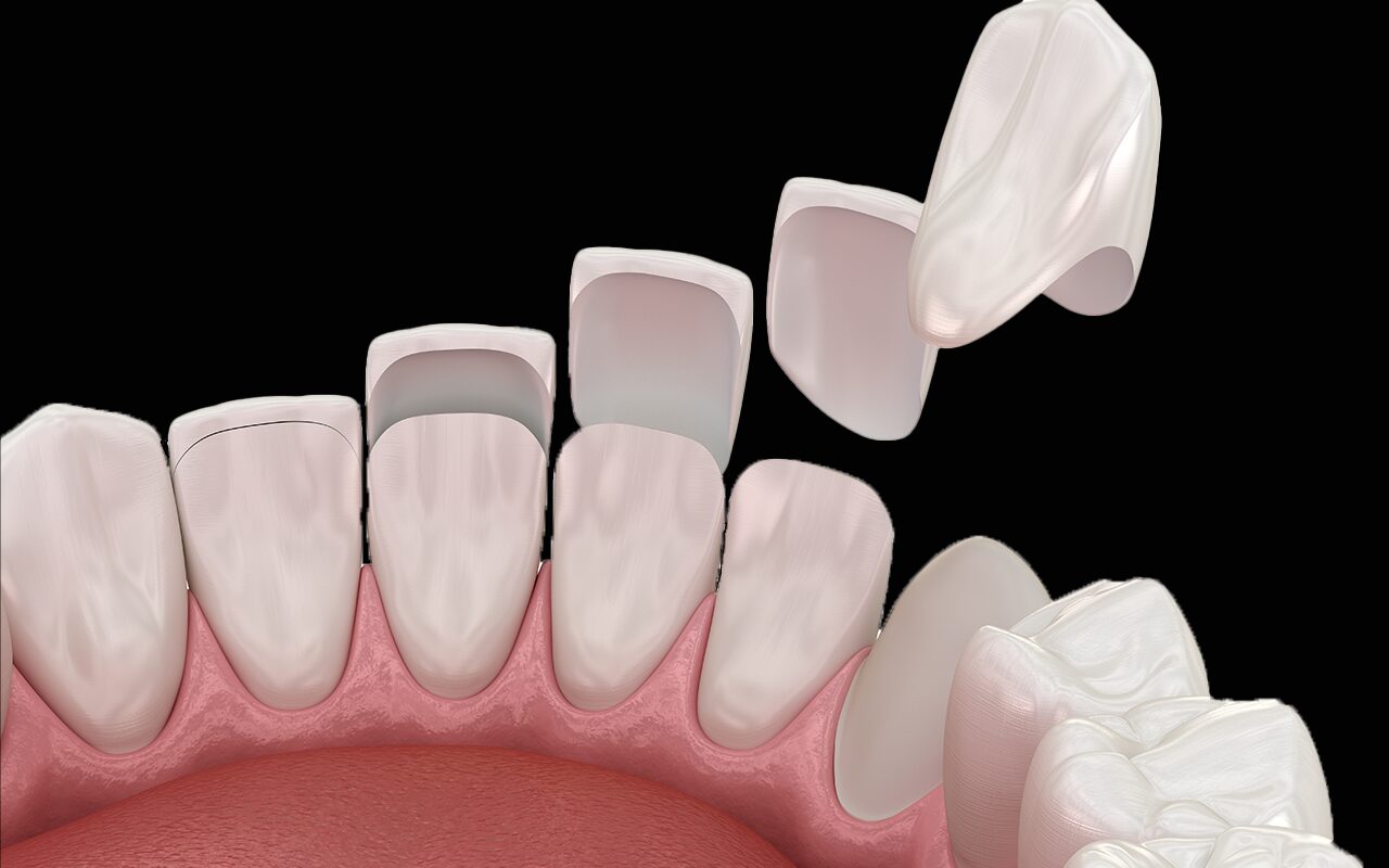 DentOne
