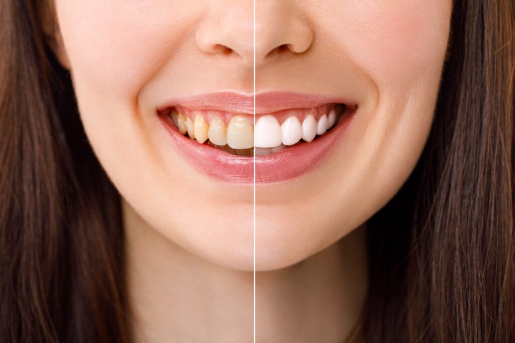 DentOne