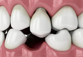 DentOne