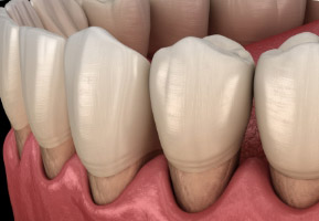 DentOne