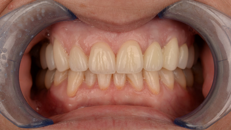 DentOne