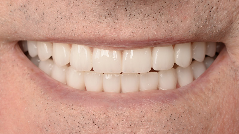 DentOne