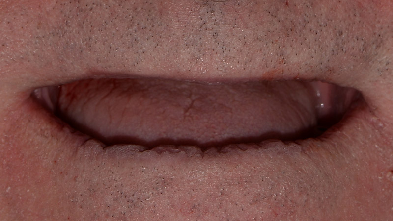 DentOne