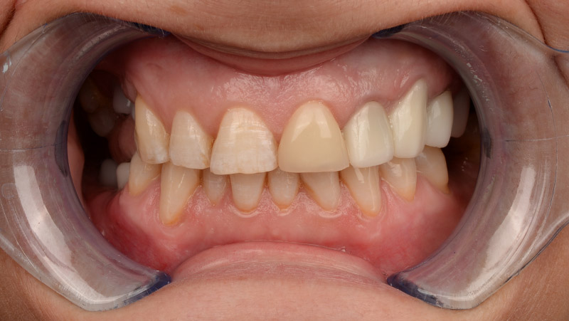 DentOne