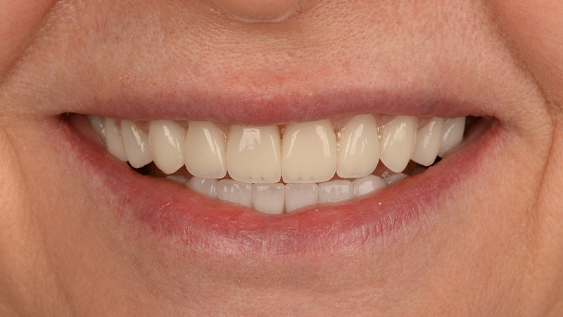 DentOne