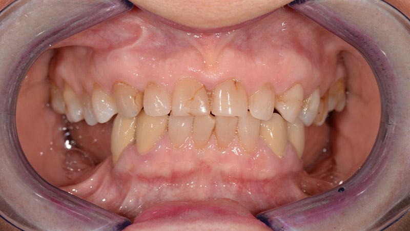 DentOne