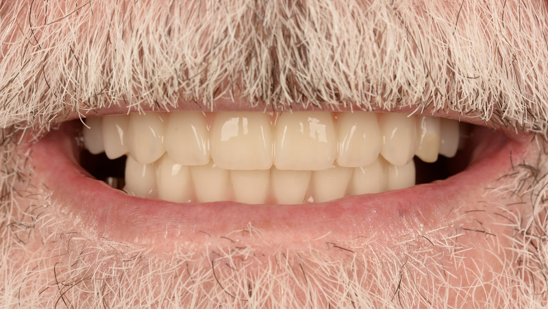 DentOne