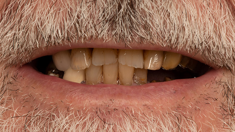 DentOne