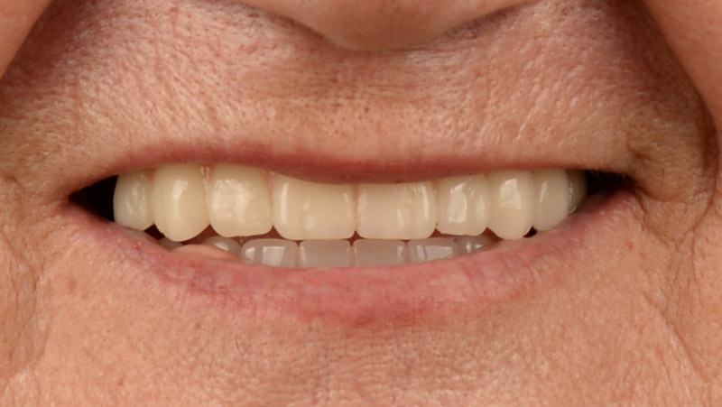 DentOne
