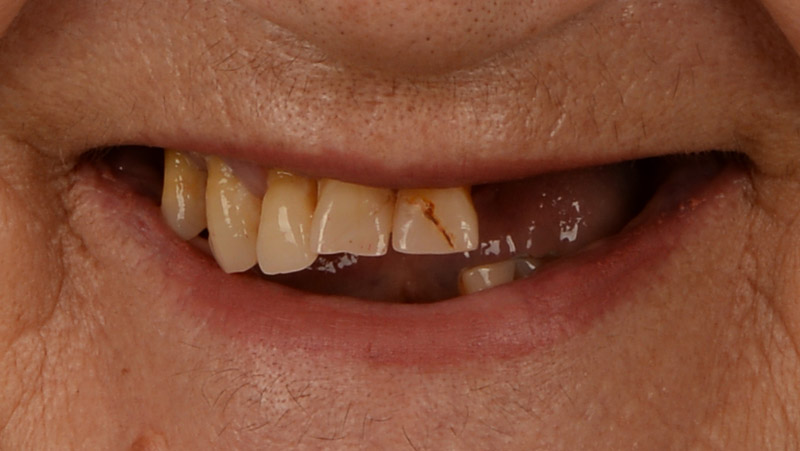 DentOne