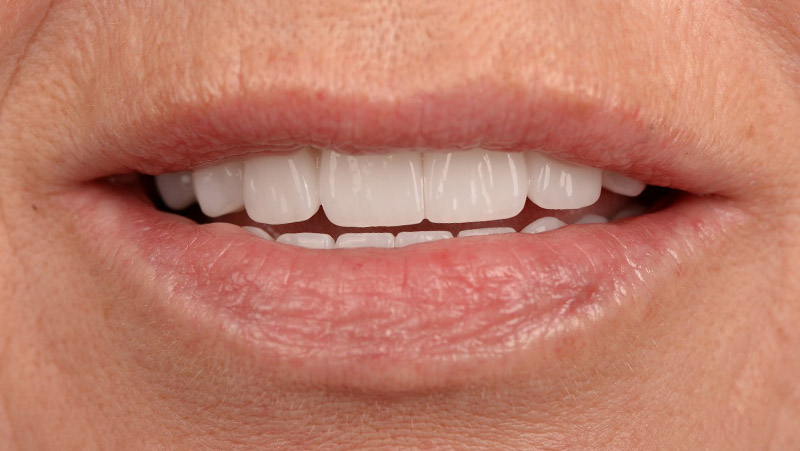DentOne