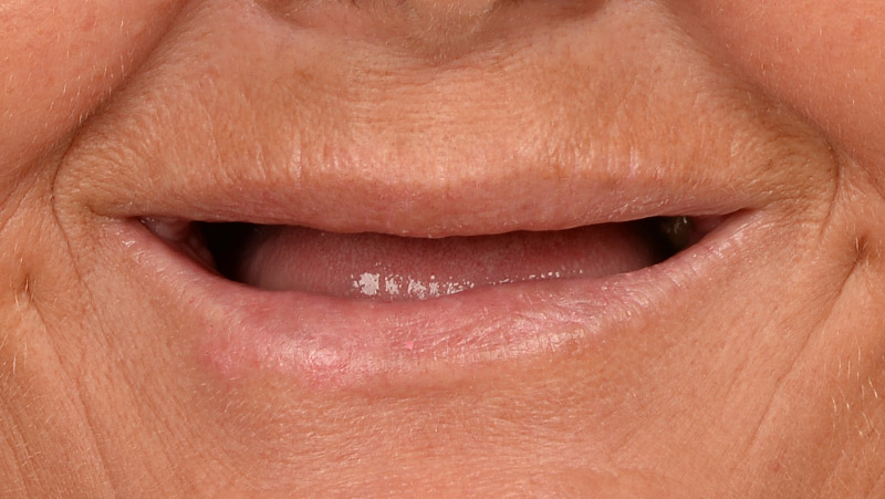 DentOne