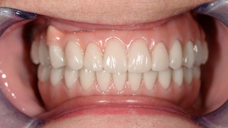 DentOne