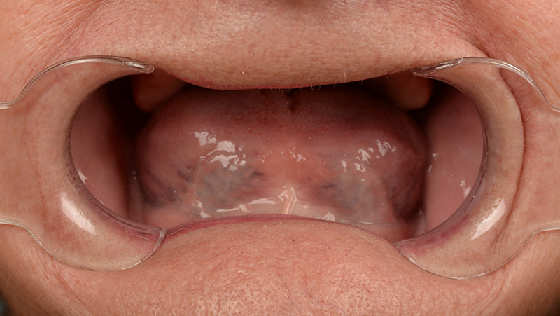 DentOne