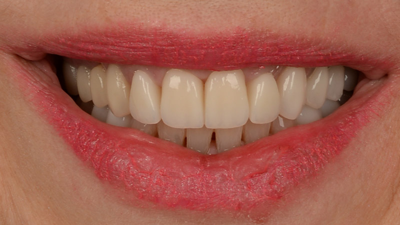 DentOne