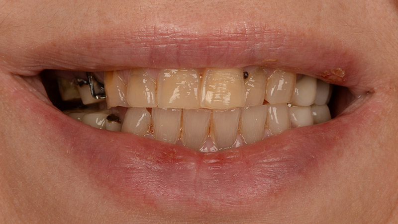DentOne
